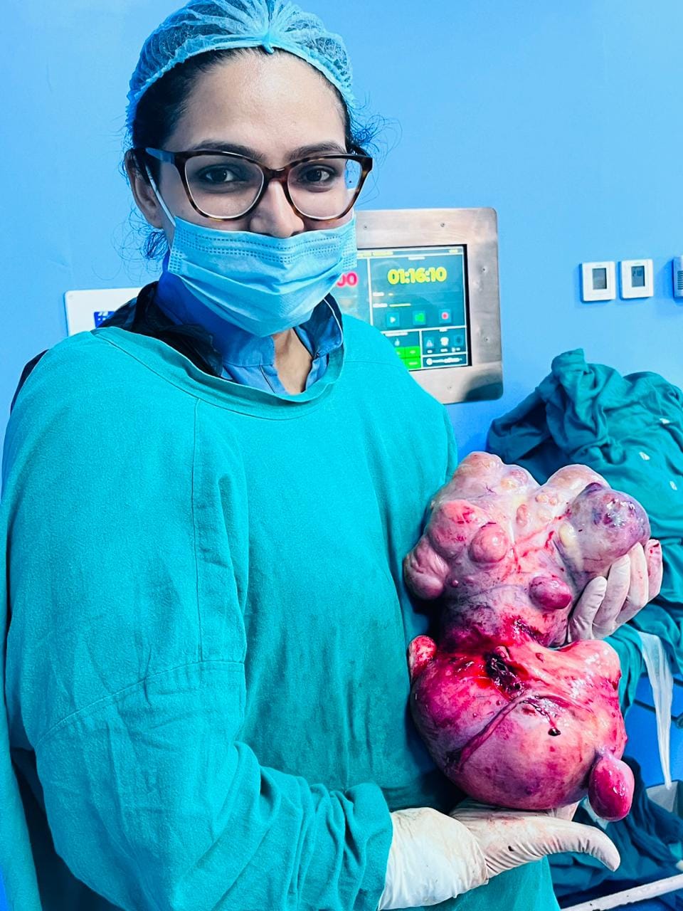 3.5 kg lump removed from uterus