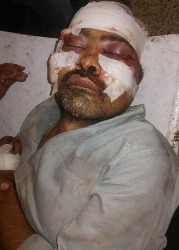 Youth sleeping in temple attacked with sharp weapon