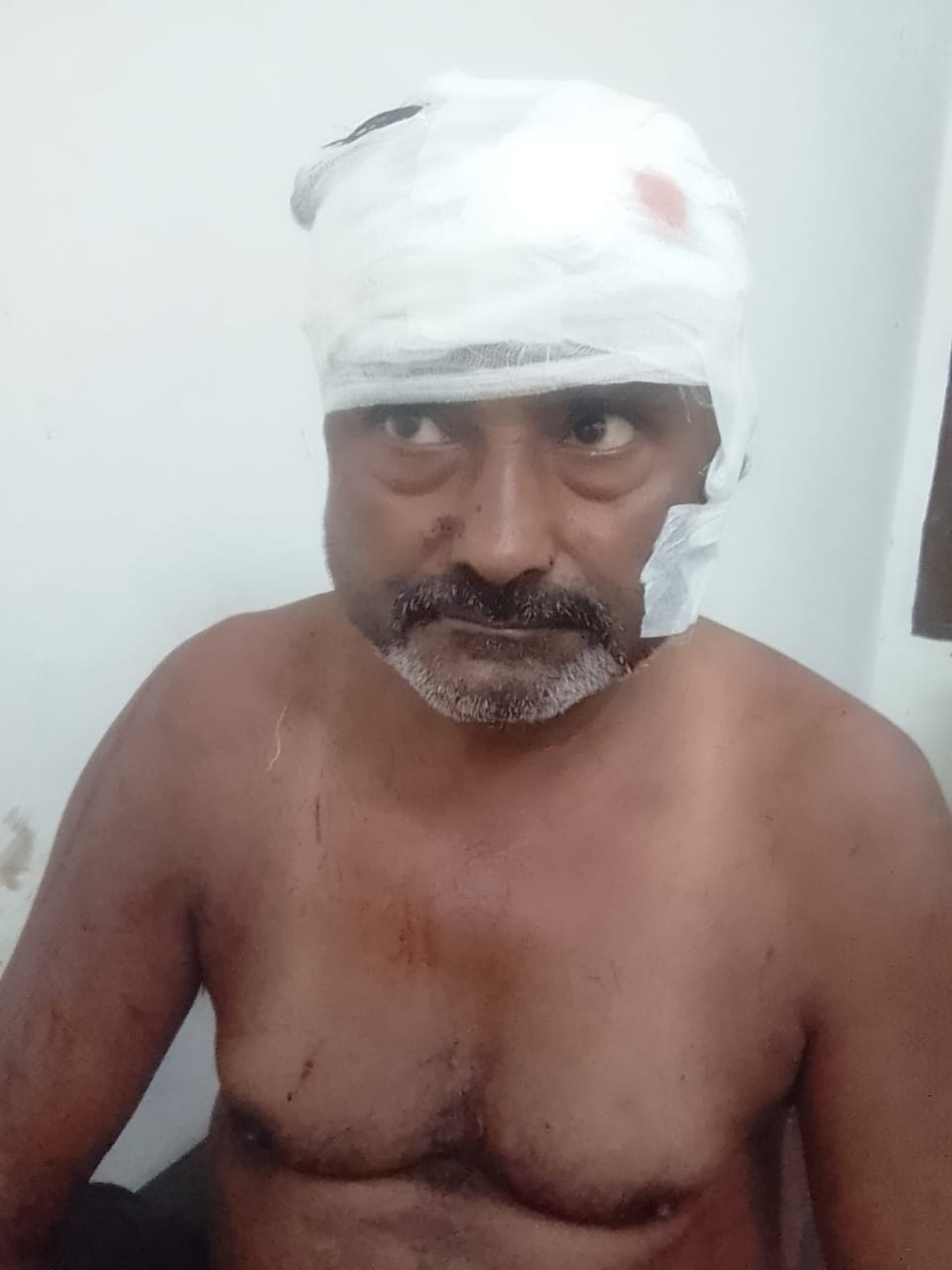 Carpenter injured in leopard attack
