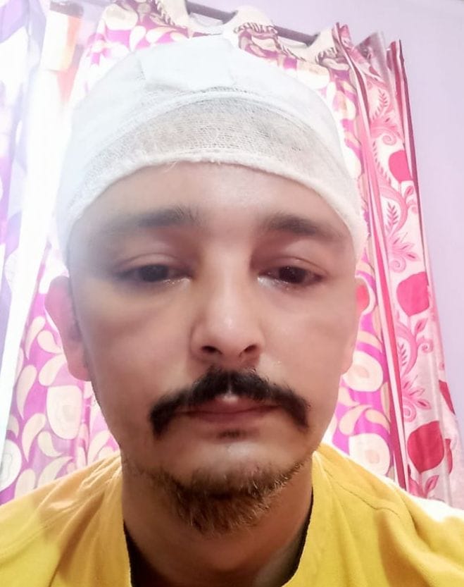Congress leader was beaten up and injured by unknown assailants
