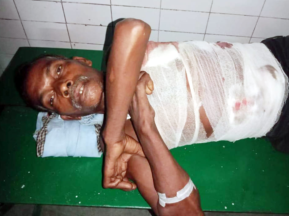 Crocodile attacked and injured the villager