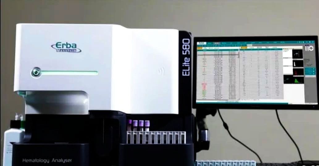 HB will be done by new machine in the hospital

33 tests including HT, RBC, TLC