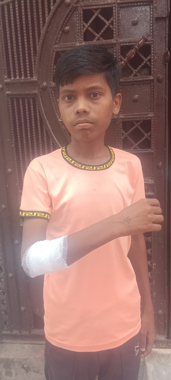 children injurd in monkey attack