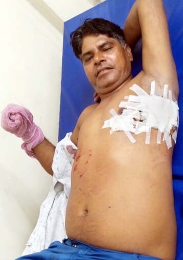 Crocodile attacks young man, injured