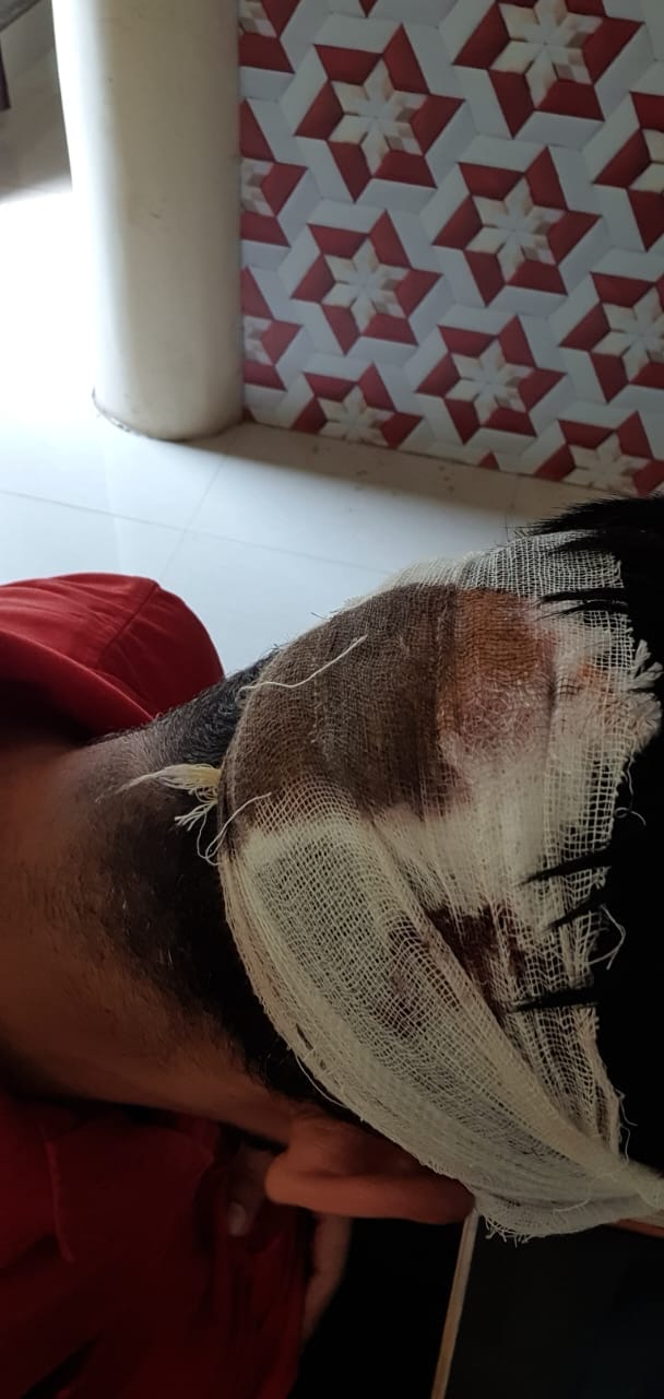 Hooliganism of toll employees, animal husbandry department's lab technician assaulted
