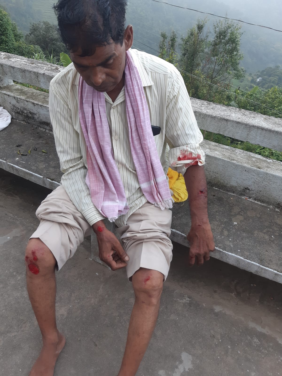 Leopard pounces on bike riding husband and wife, husband injured