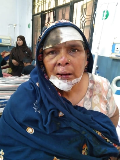 Scooty-bike collision, two injured including female councilor