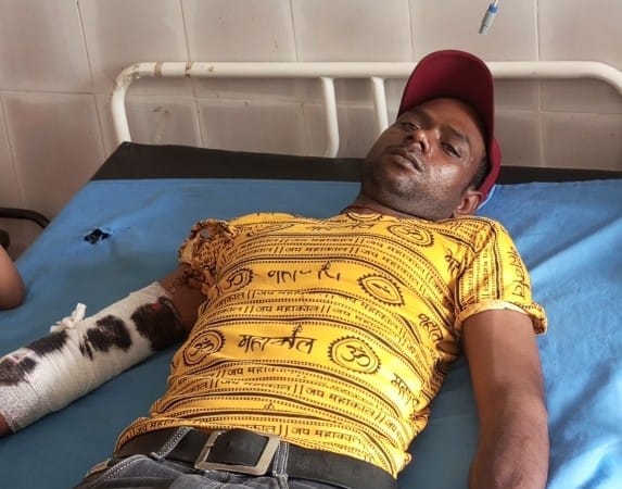 Two people including girl riding scooter injured in leopard attack