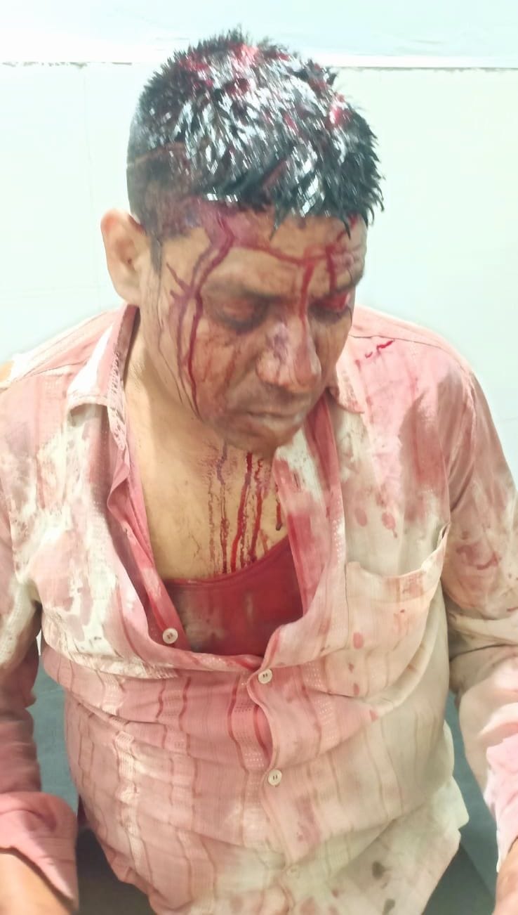 Miscreants entered Guru Dronacharya College, attacked the watchman, took away files and cash.