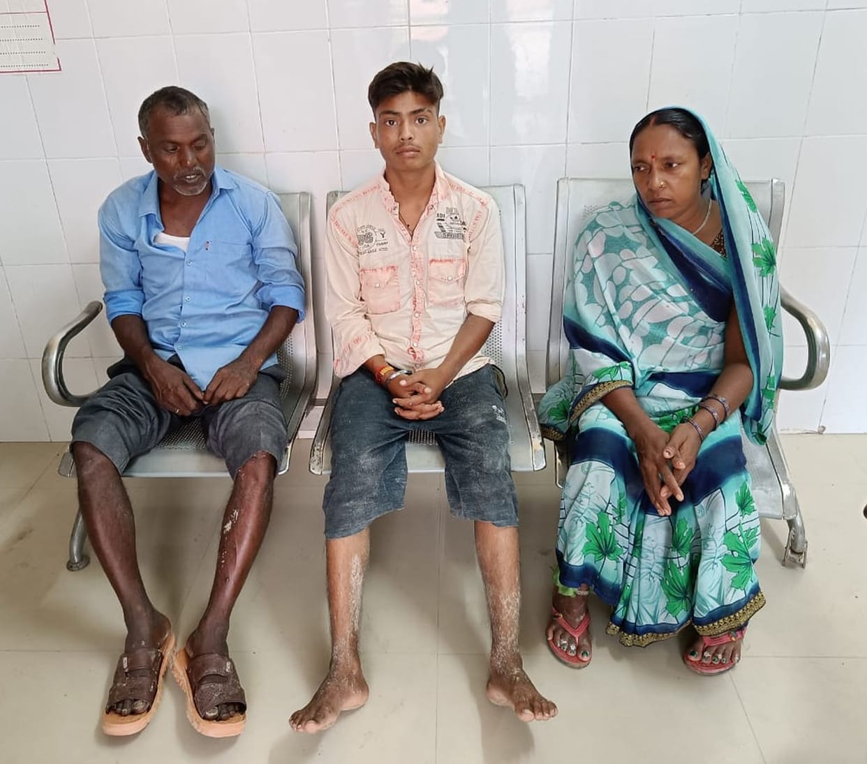 Three including a couple burnt due to lightning, admitted