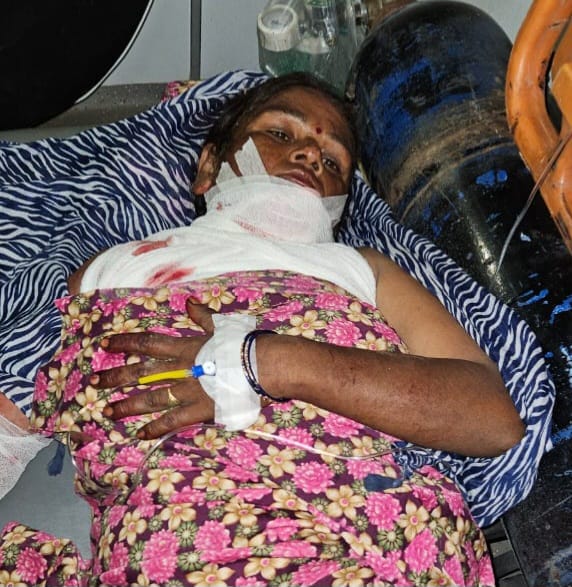 Woman injured in Guldar attack in village Asafabad Chaman