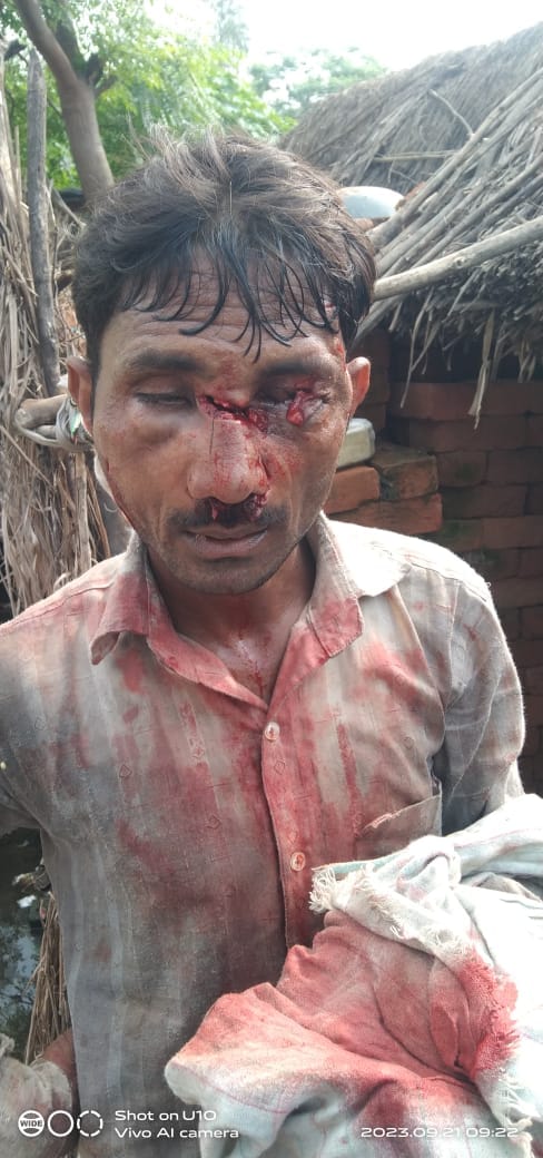 Tiger attacks young man who went to collect fodder