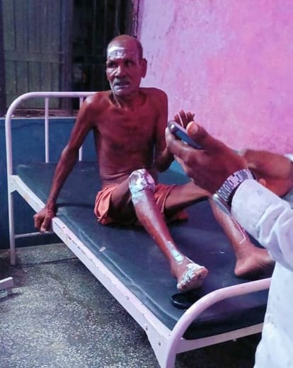 Fire broke out due to leaking cylinder, six members of the same family got burnt