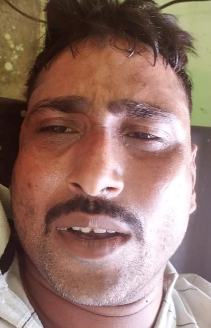 Bike thief attacks Suze in encounter, three policemen injured
