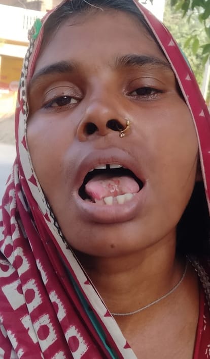 Tried to suppress her neck and then bit his wife's tongue with his teeth.