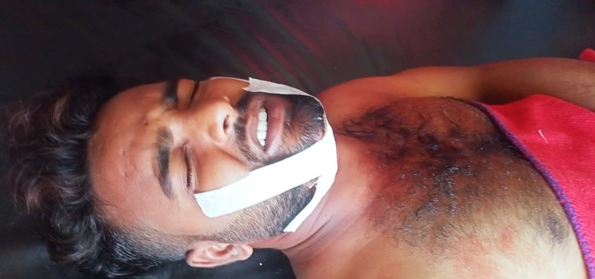 Both drivers injured when bikes collide with each other