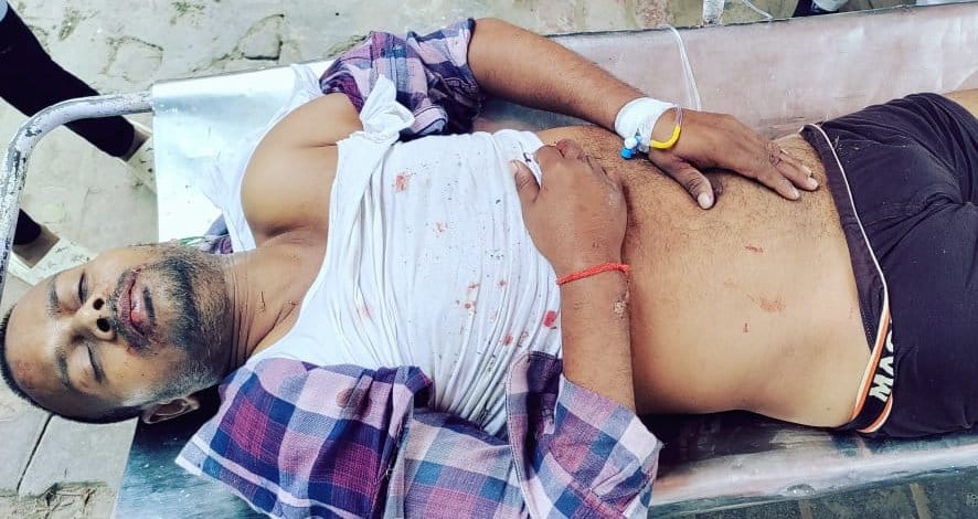 Bike blown apart due to collision with uncontrolled Bolero, youth seriously injured