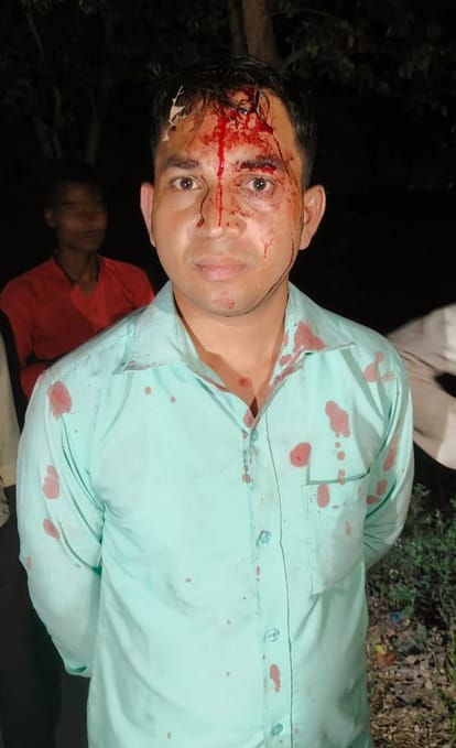 Ward boy beaten by bike riders