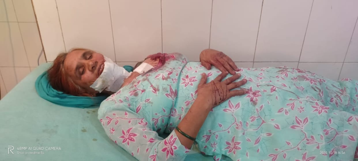 The thief attacked the teacher with a knife, she gathered courage and ran to catch the accused.