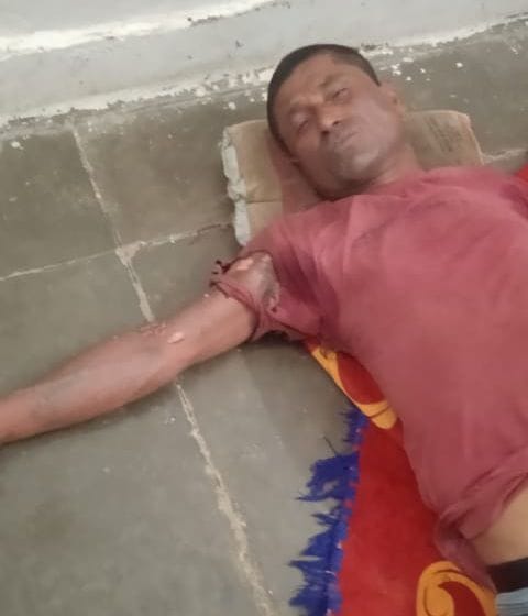 Young man gets burnt due to electric shock while connecting connection, commotion