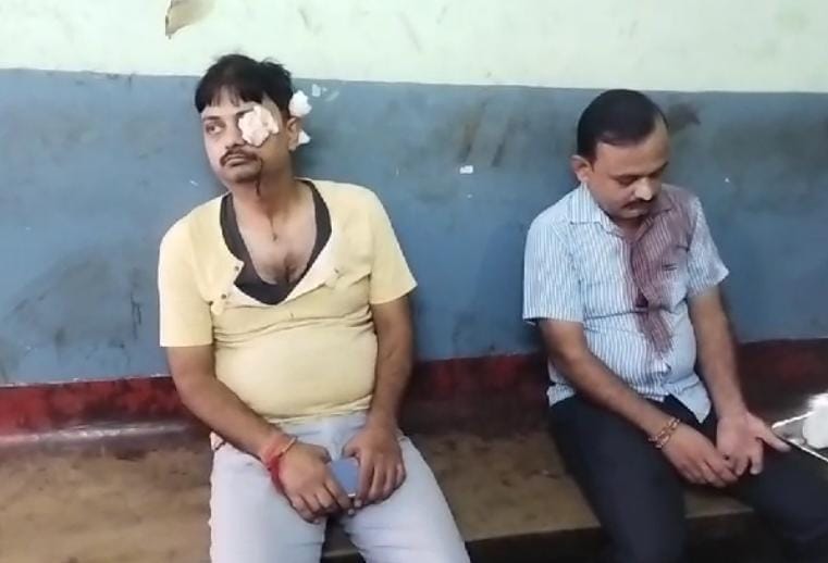 Drug addict injured two brothers with knife attack