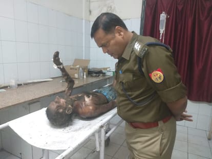 Elderly man burnt under suspicious circumstances, says daughter-in-law set him on fire