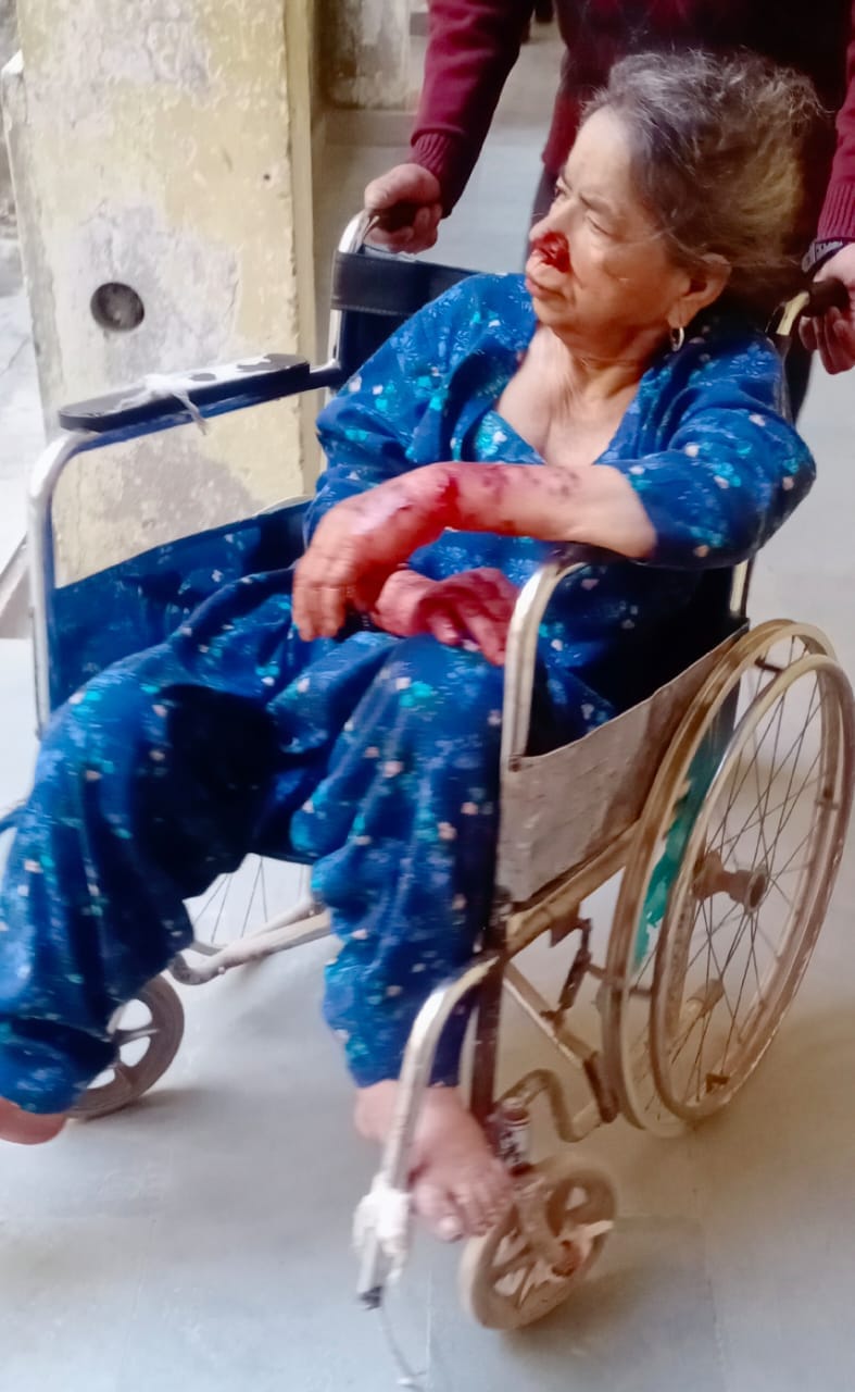 Half a dozen people bitten by stray dogs in Surani