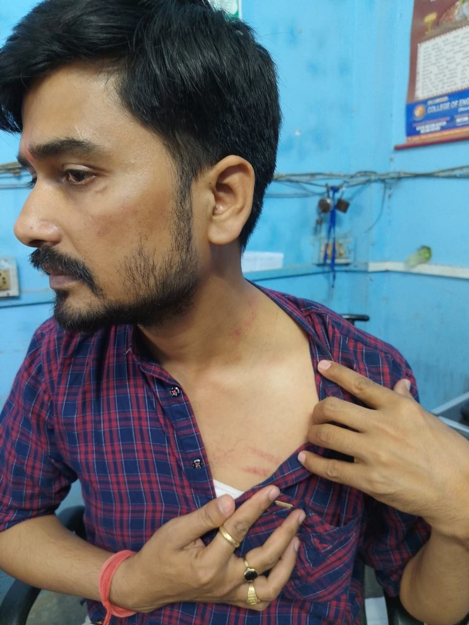 attack on ornament seller