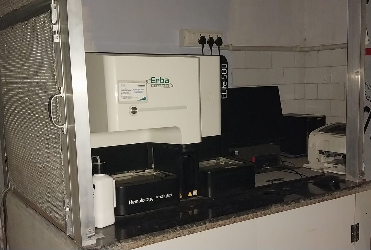 Chemicals run out in hospital lab, 21 types of blood tests affected