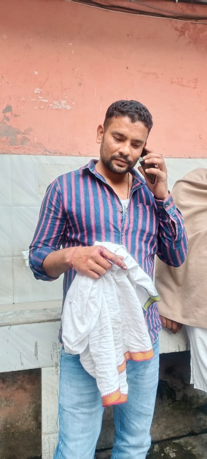 Clash on the square of Kisan Bhawan, heavy lathi charge, 20 injured