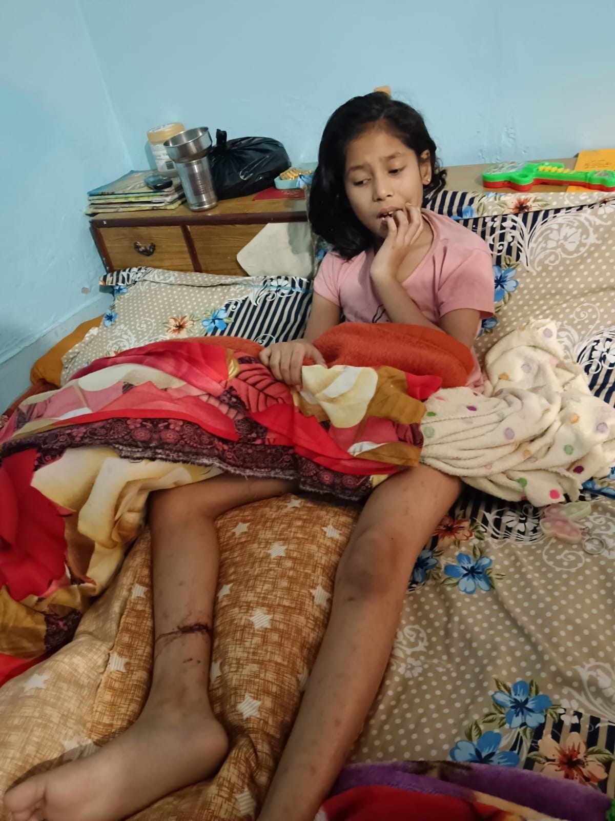 Eight year old girl bitten by pet dog, injured