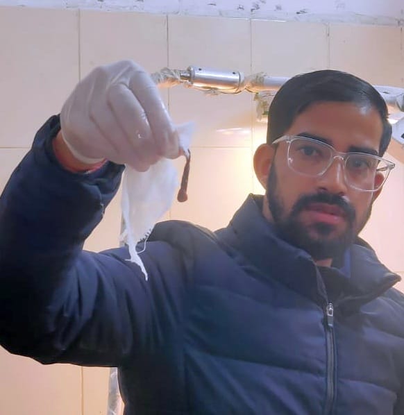 Three inch long leech came out of young man's nose