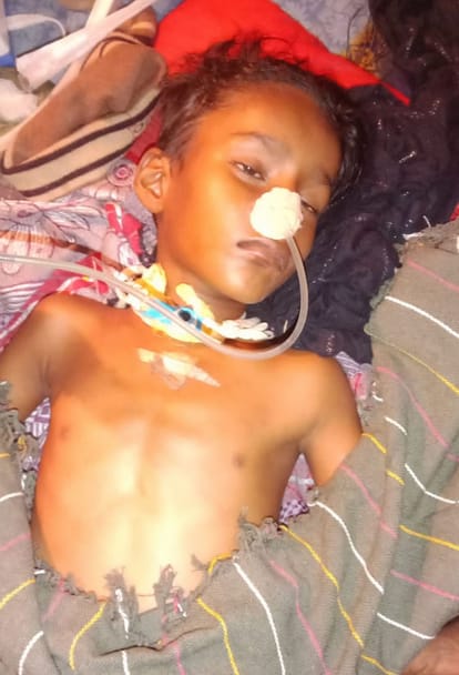 No money for treatment, Rachit is struggling with life
