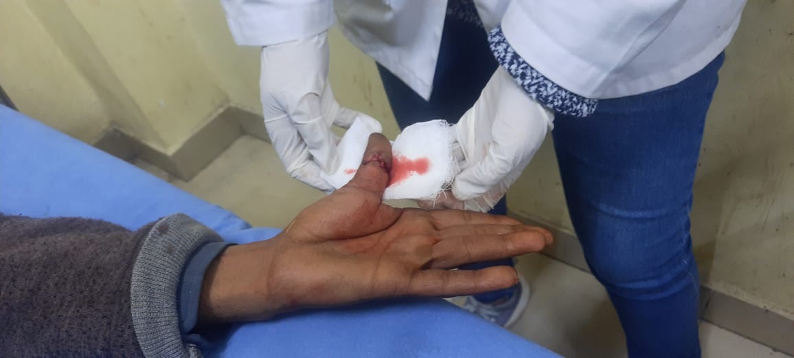 Abandoned dog bites five people, woman referred to PGI