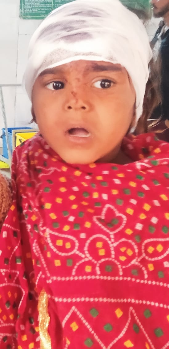 In Taranagar, a ferocious dog bit an innocent girl, she got 17 stitches on her head.