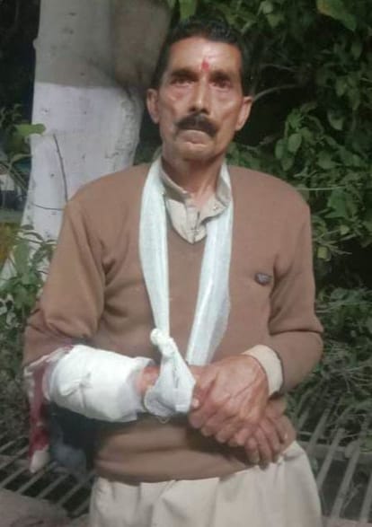 Liquor salesman fired on, bullet hit on his hand