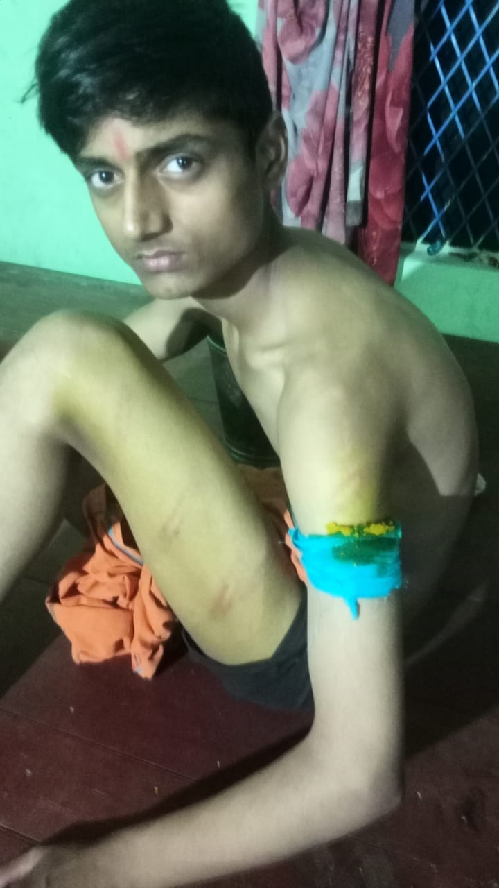 Manager beats up student accused of demolishing boundary wall, case registered