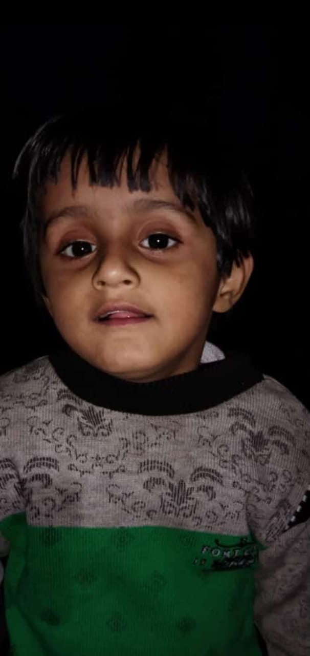 Six year old girl dies in attack by stray dogs