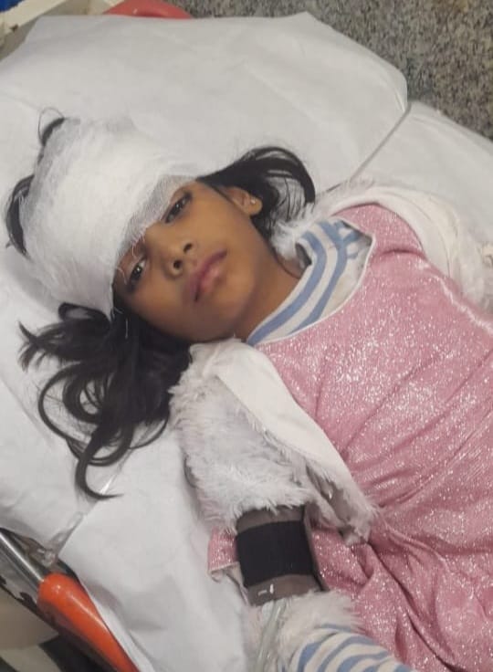 Balcony fell on girls during party, one died