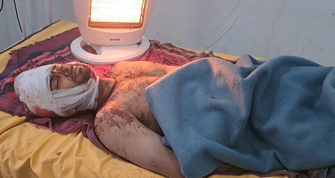 Brother-in-law along with two associates attacked brother-in-law