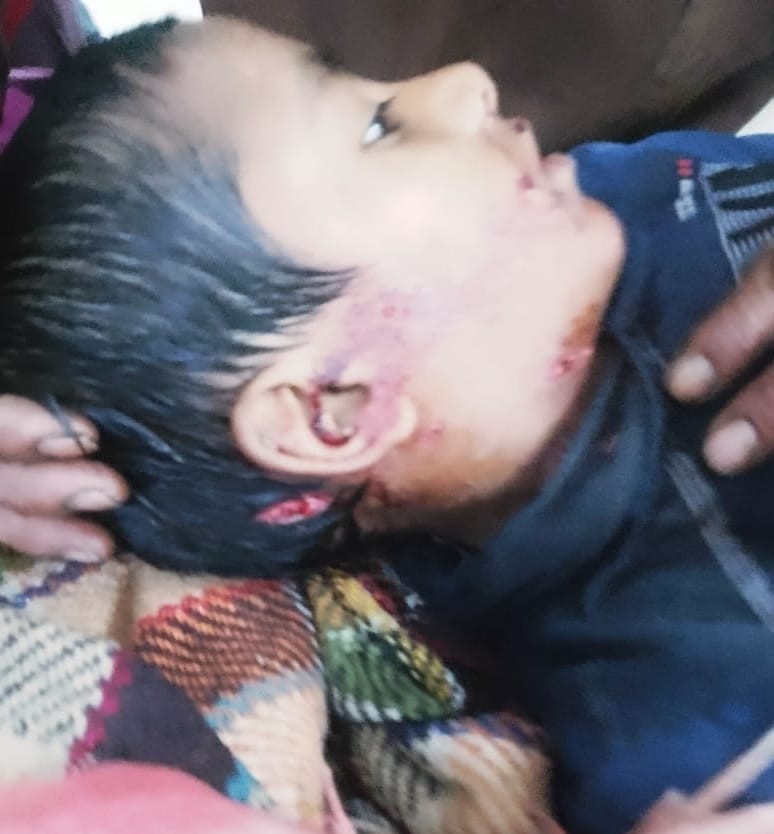 The boy was taken away by a thug, grandfather and uncle ran and rescued him.