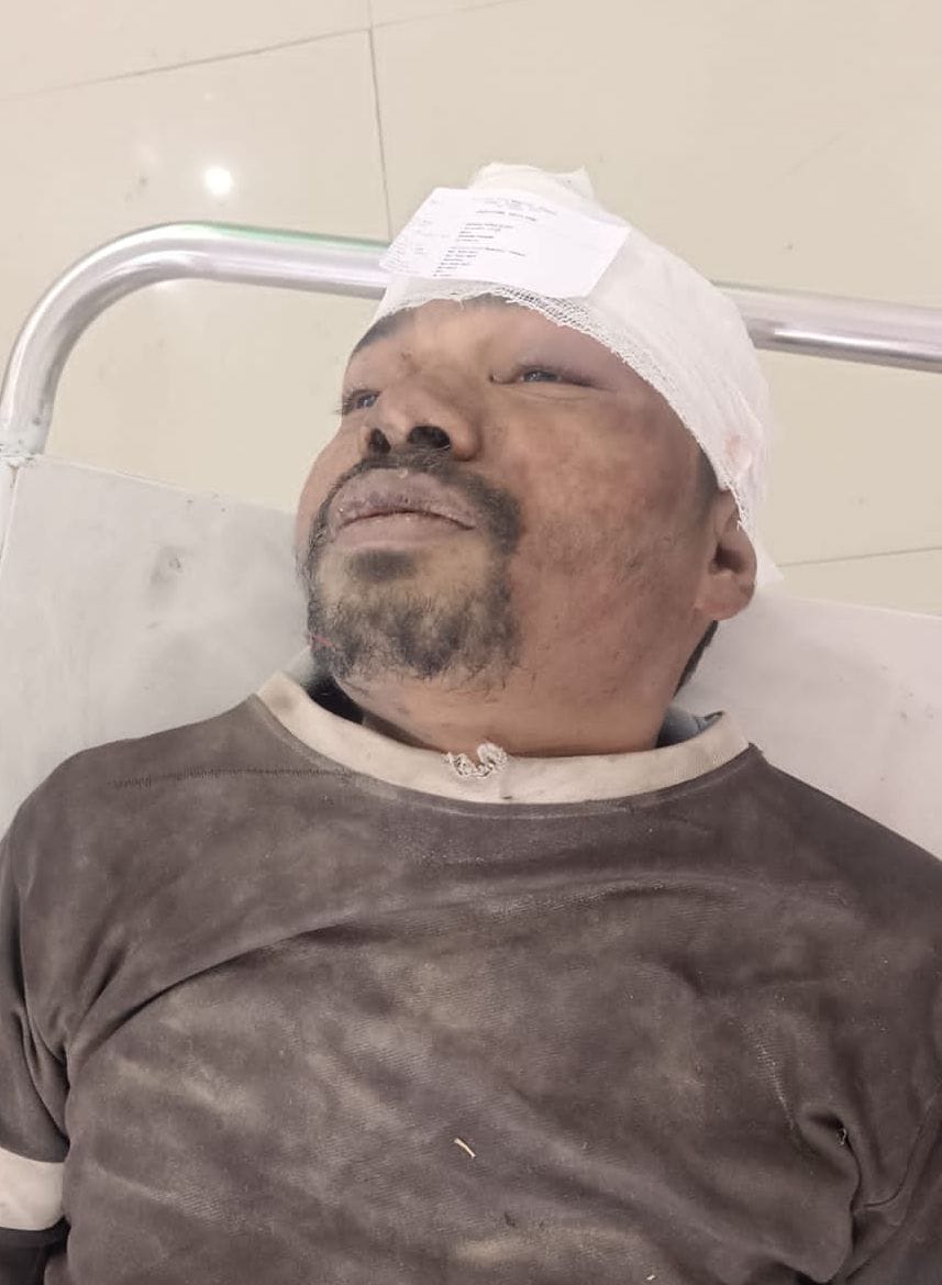 The young man was murdered by hitting his head.