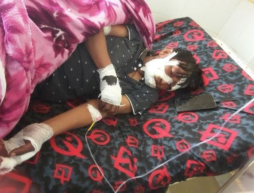 Leopard tore jaw of wedding attendee, injured two others
