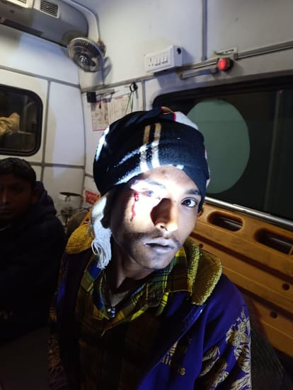 Firing over a dispute over crossing the road, a shrapnel hit on the cheek