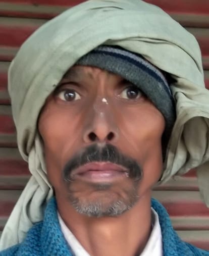 How should the treatment be done...Dentists posted at 15 CHCs but no equipment