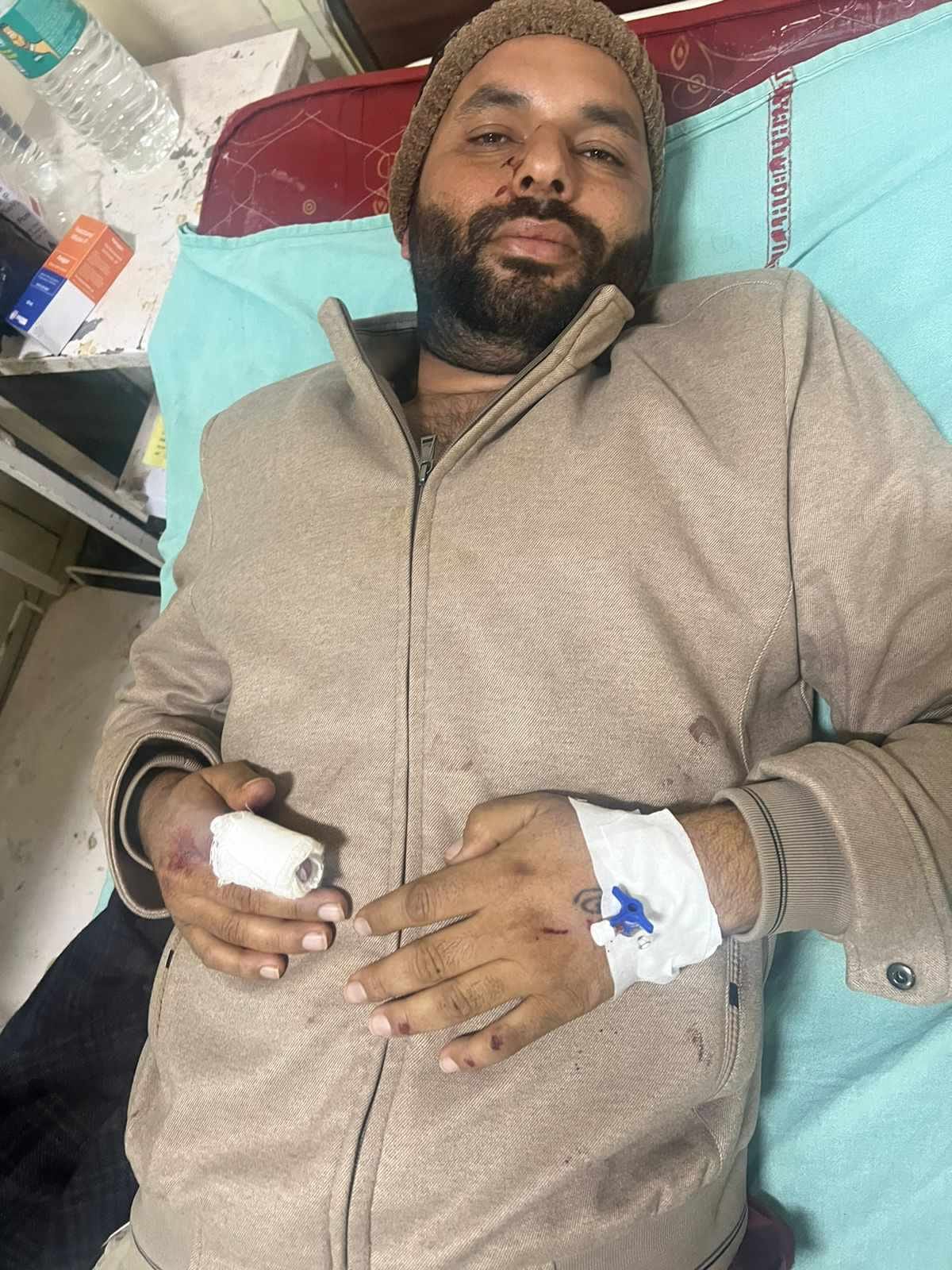Due to dispute over breaking cameras, neighbors entered the house and beat up the young man, case registered against three