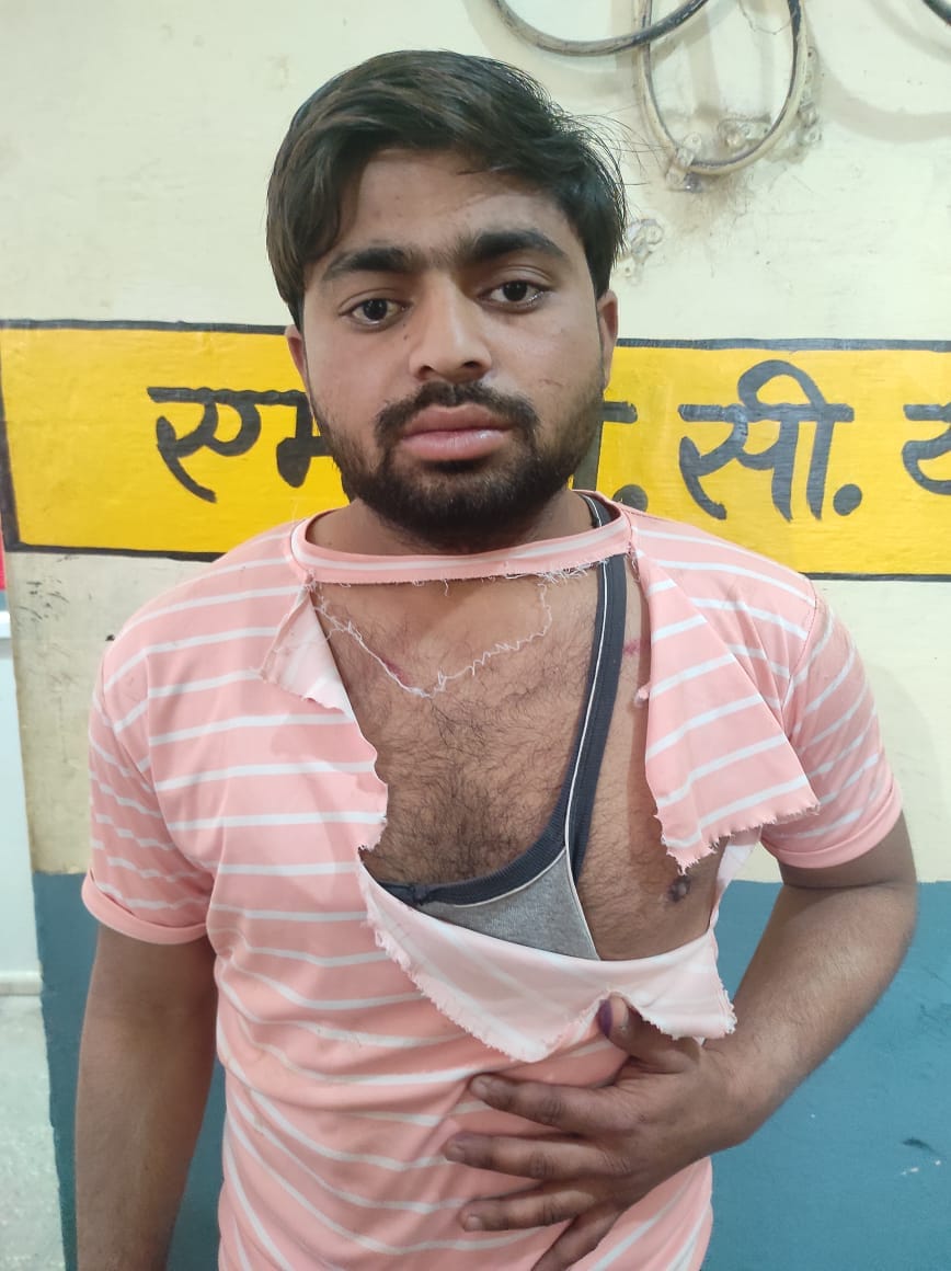 Injured by beating with bricks, condition critical