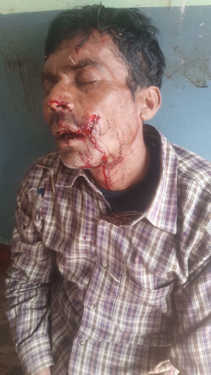 Tiger attacks laborer peeling sugarcane