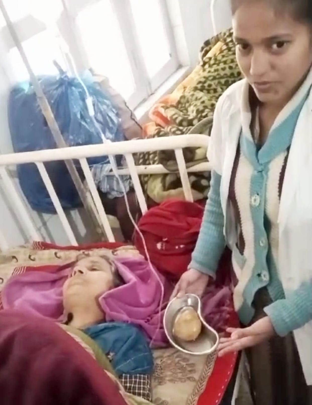 230 gram stone came out from woman's stomach