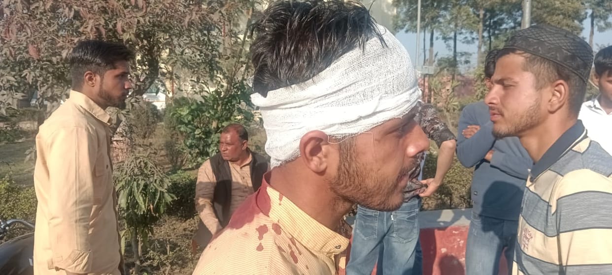 Stones pelted on side of vehicle, five injured including BJP leader